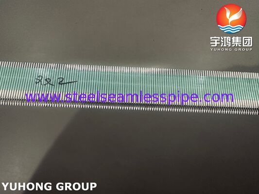 Cánula AVF de acero inoxidable médico SUS304 de alto rendimiento para hemodiálisis con rango de calibre 15G-17G y superficie micropulida